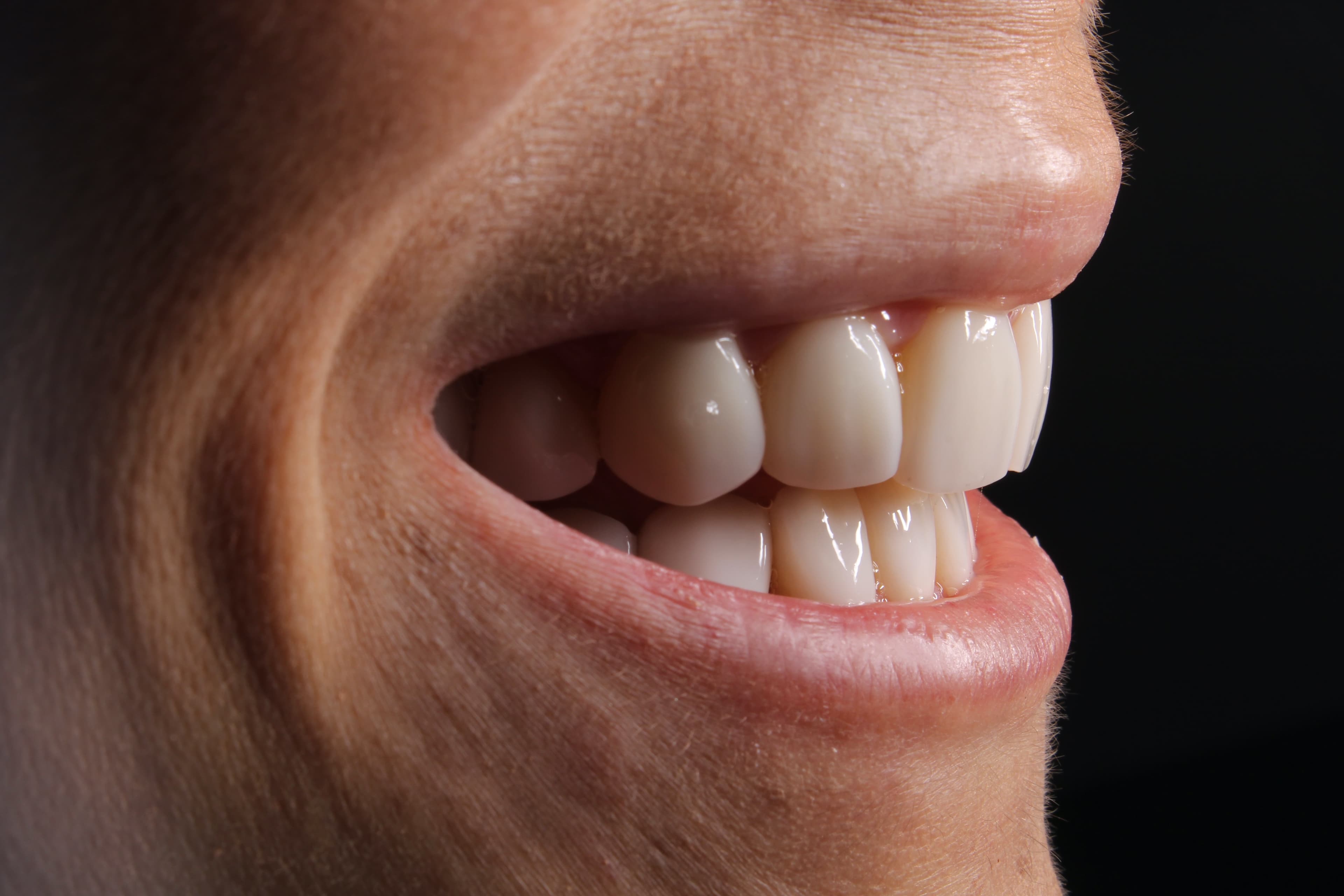 Philmont Family Dentistry - Dentist in Philmont, NY