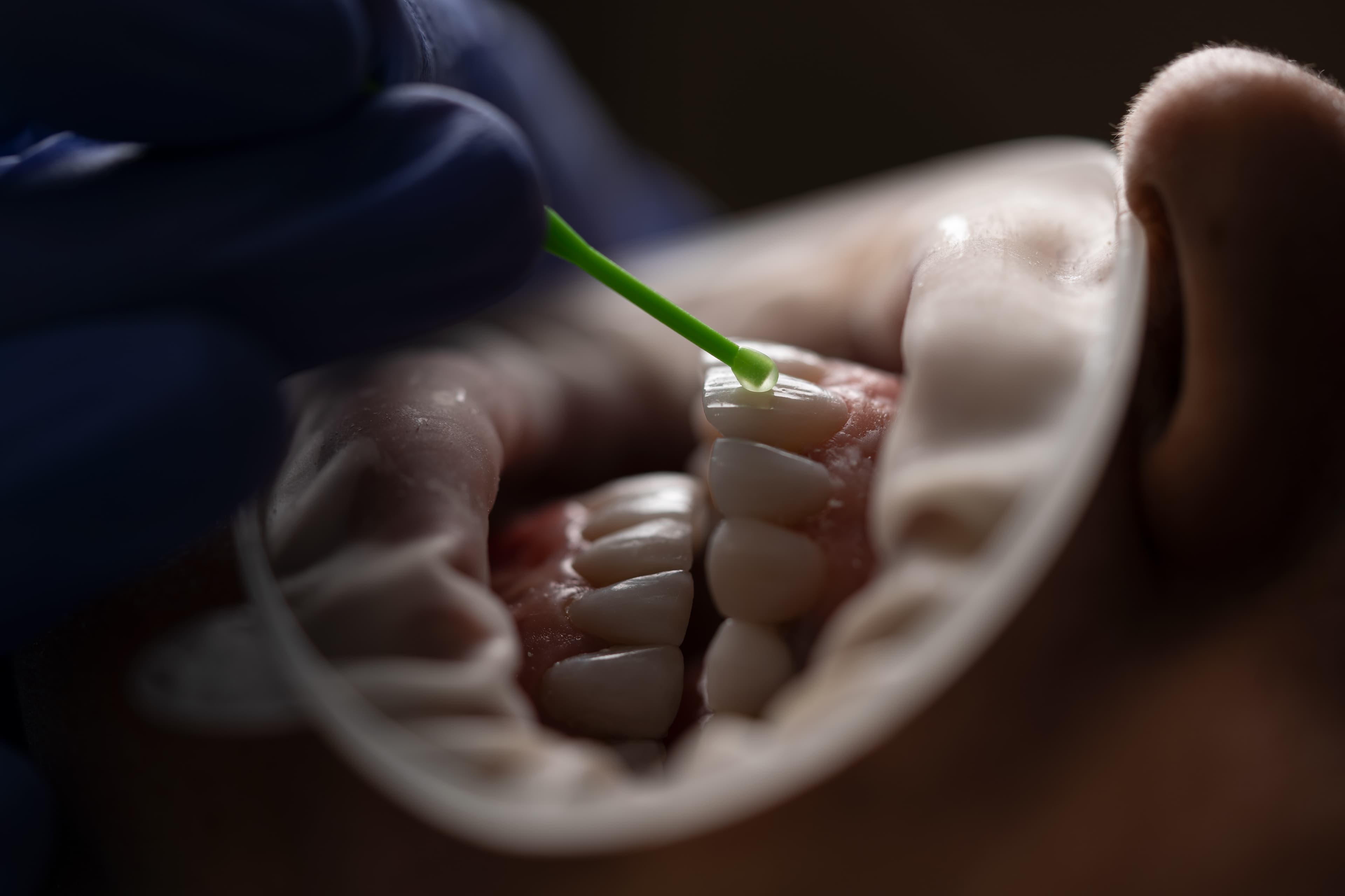 Philmont Family Dentistry - Dentist in Philmont, NY